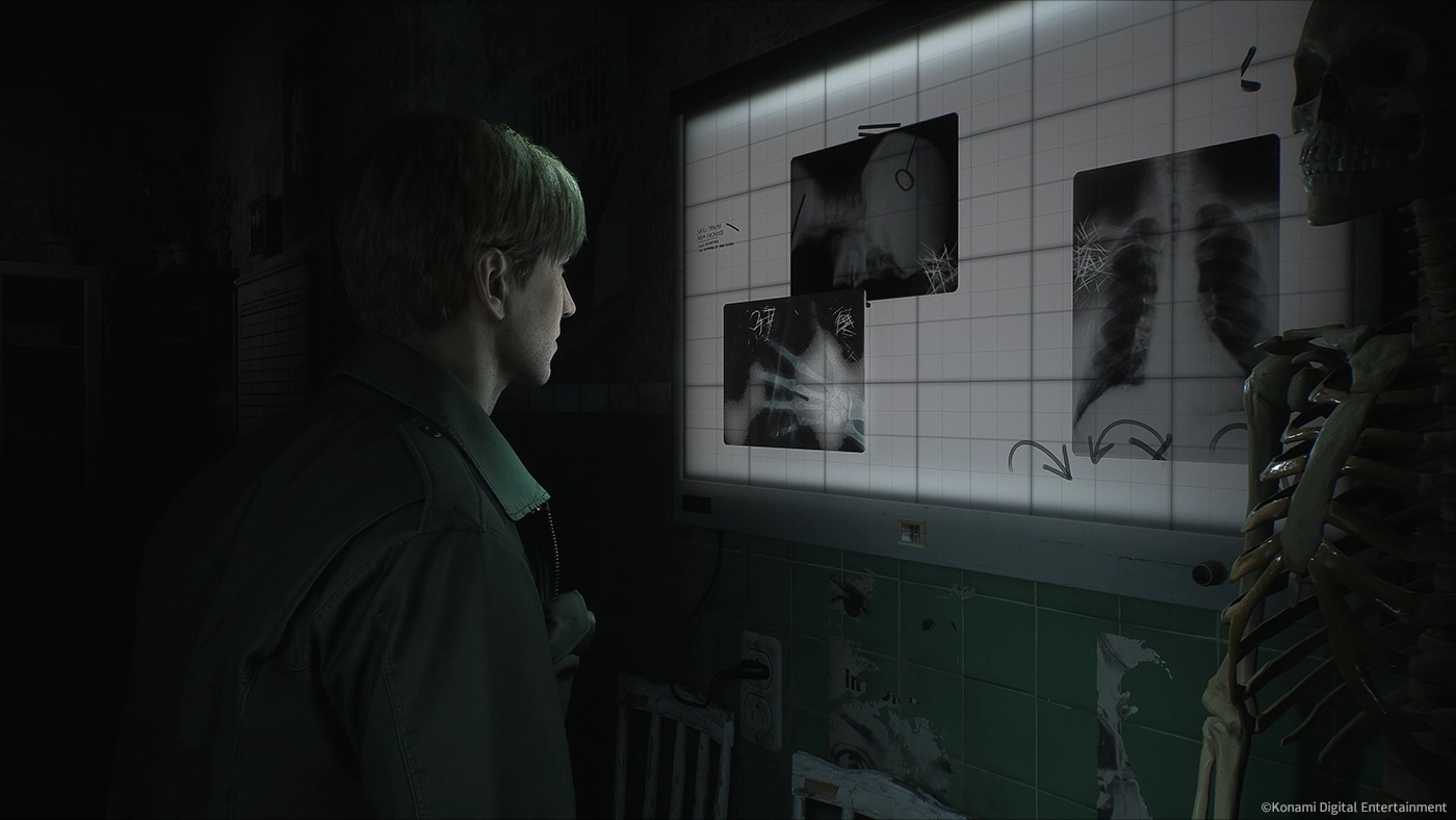 Silent Hill 2 Remake: Bloober Team's Masterful Revival Surpasses 2 Million Sales - Image 1